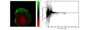 Principal Components Analysis (PCA) of hypoxic tumour sample