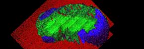 Rat kidney showing zones of chemical difference (SIMS data)